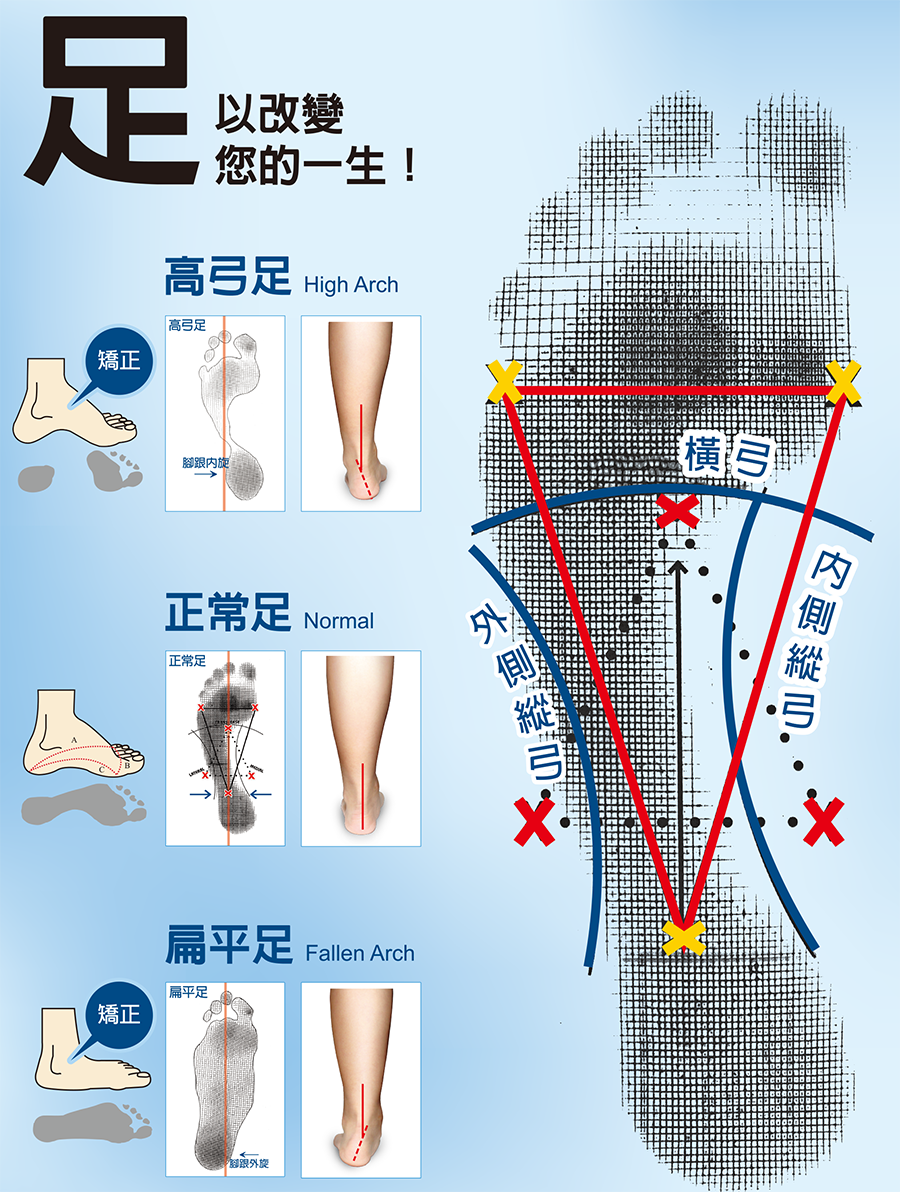 足_三種足弓