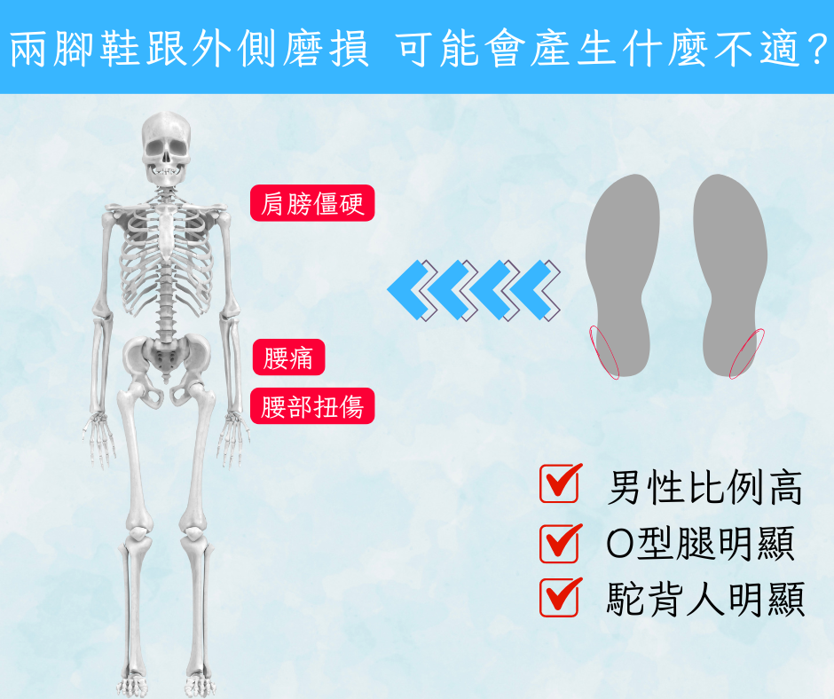 兩腳鞋跟外側磨損