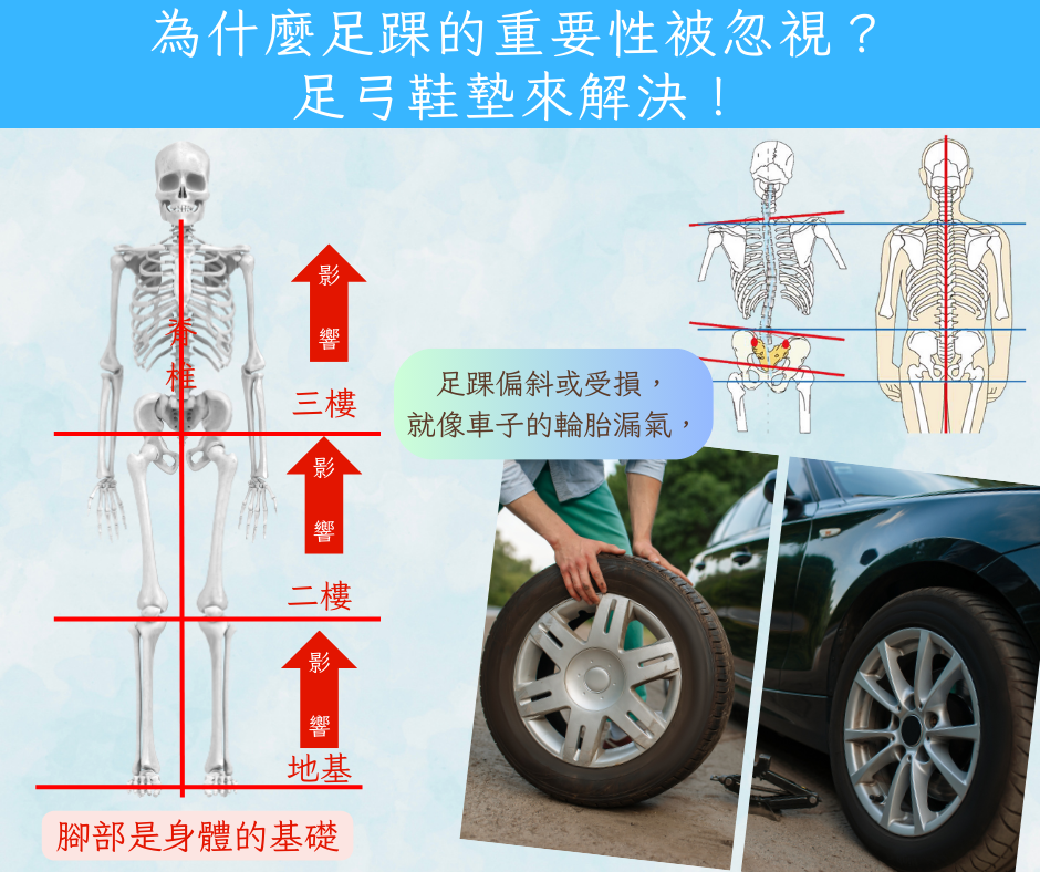 足踝偏斜或受損，這就像車子的輪胎漏氣