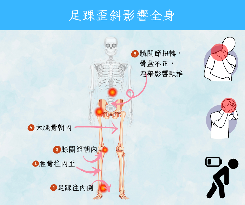 足踝骨位不正的後果